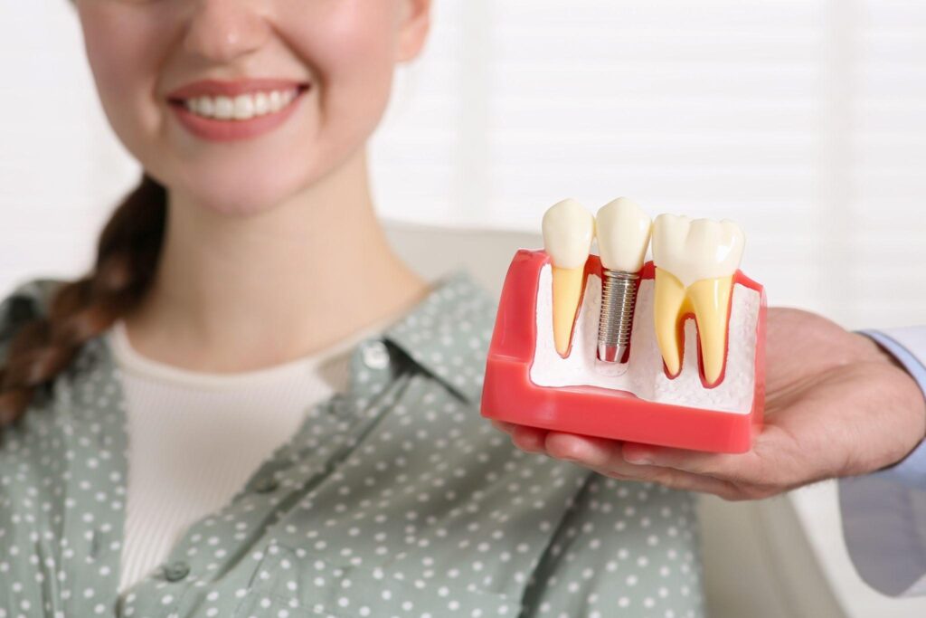 Full mouth dental rehabilitation